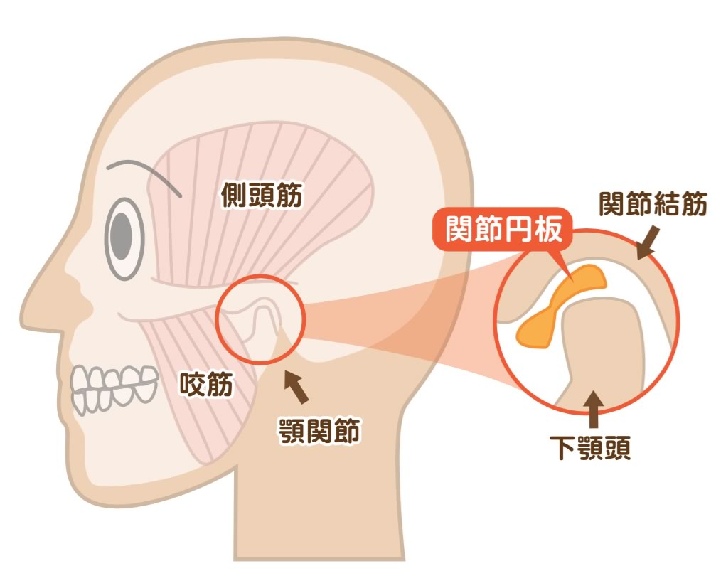 症 額 関節 痛