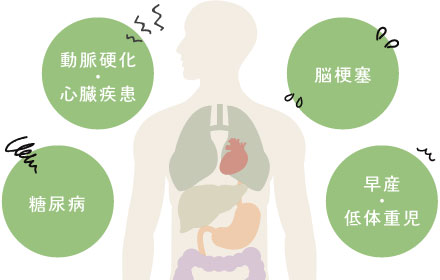 「動脈硬化・心臓疾患」「脳梗塞」「糖尿病」「早産・低体重児」
